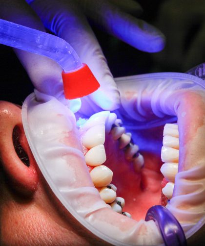 wstawianie implantów stomatologicznych w krakowie